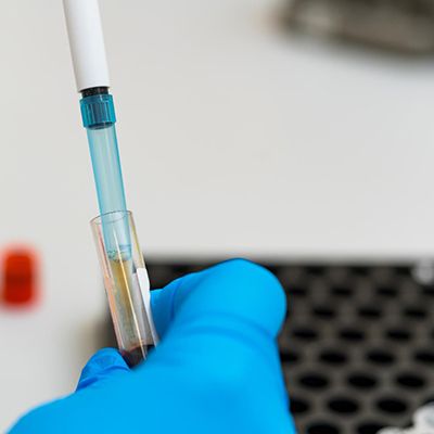 Liquid Biopsy & MRD Testing