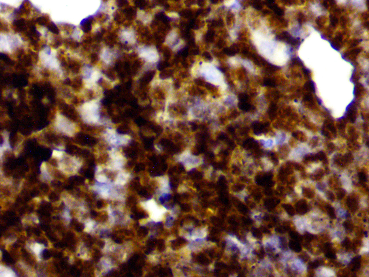 ihc1