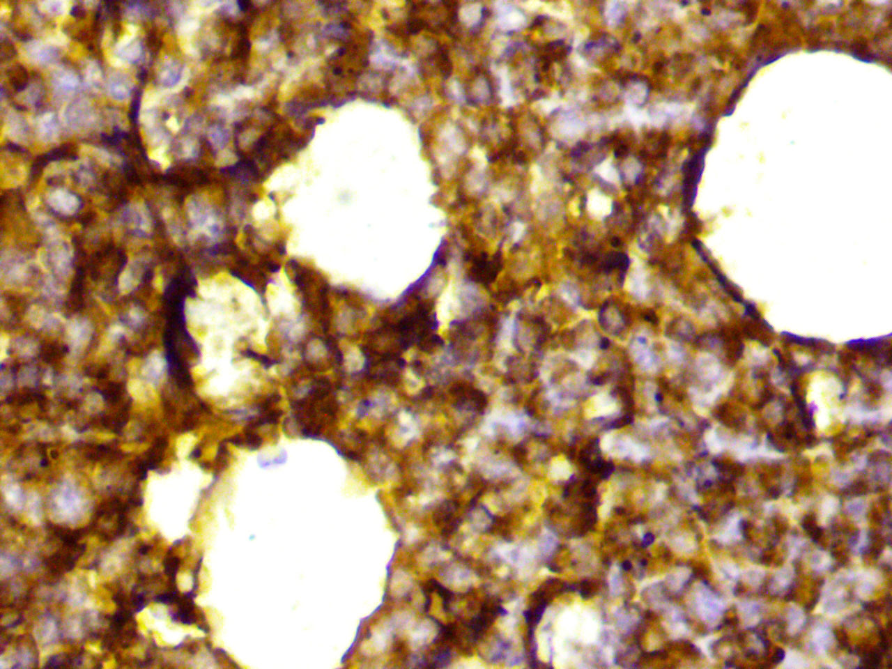 ihc10