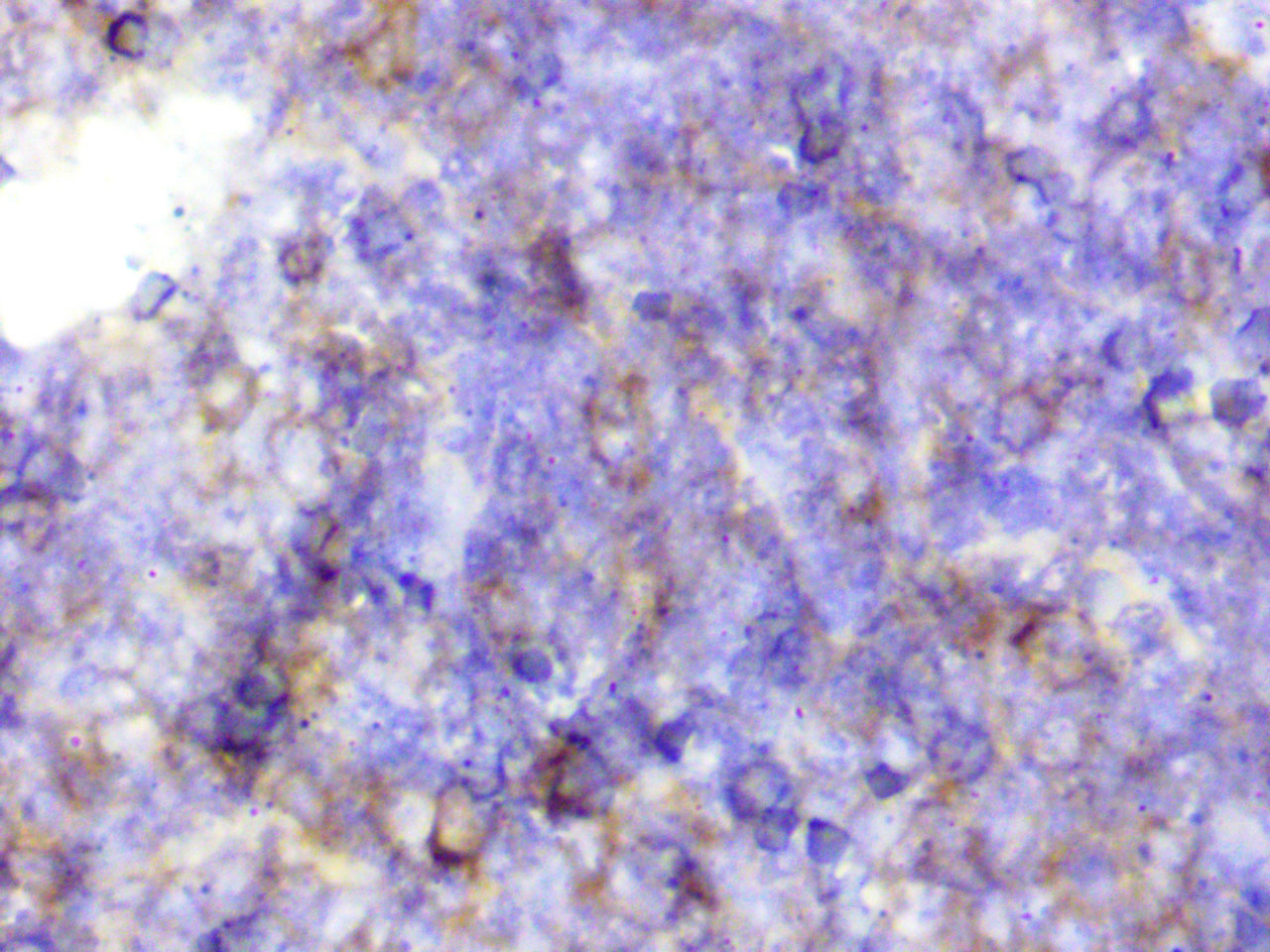 ihc11