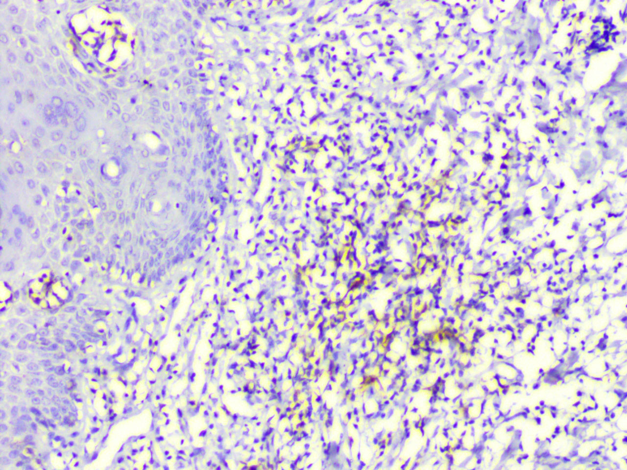 ihc12
