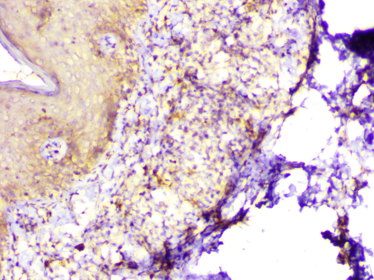 ihc13
