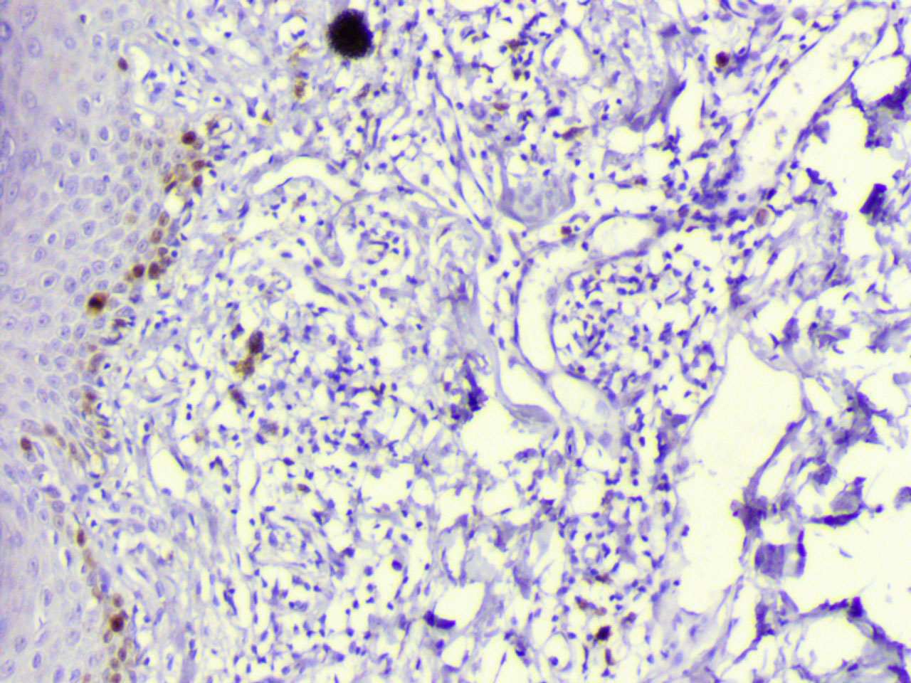 ihc15
