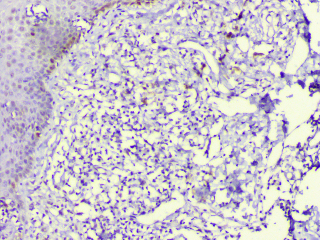 ihc16