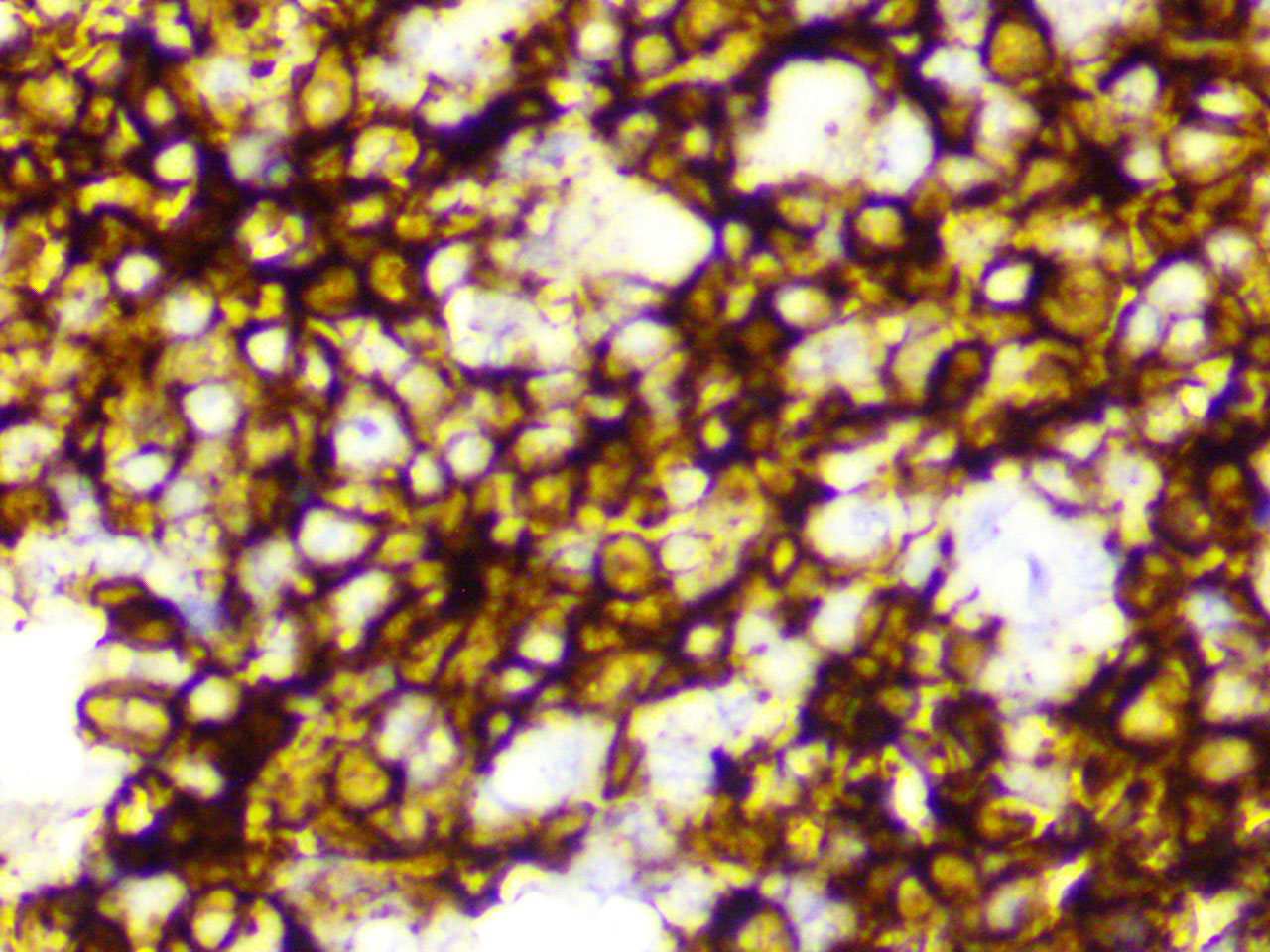 ihc18