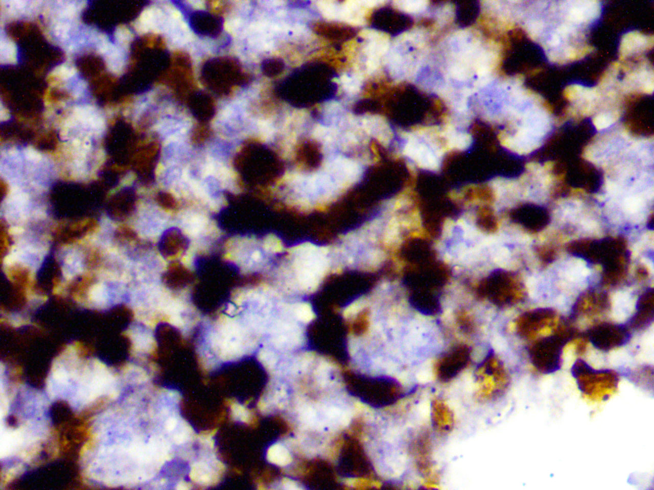 ihc19