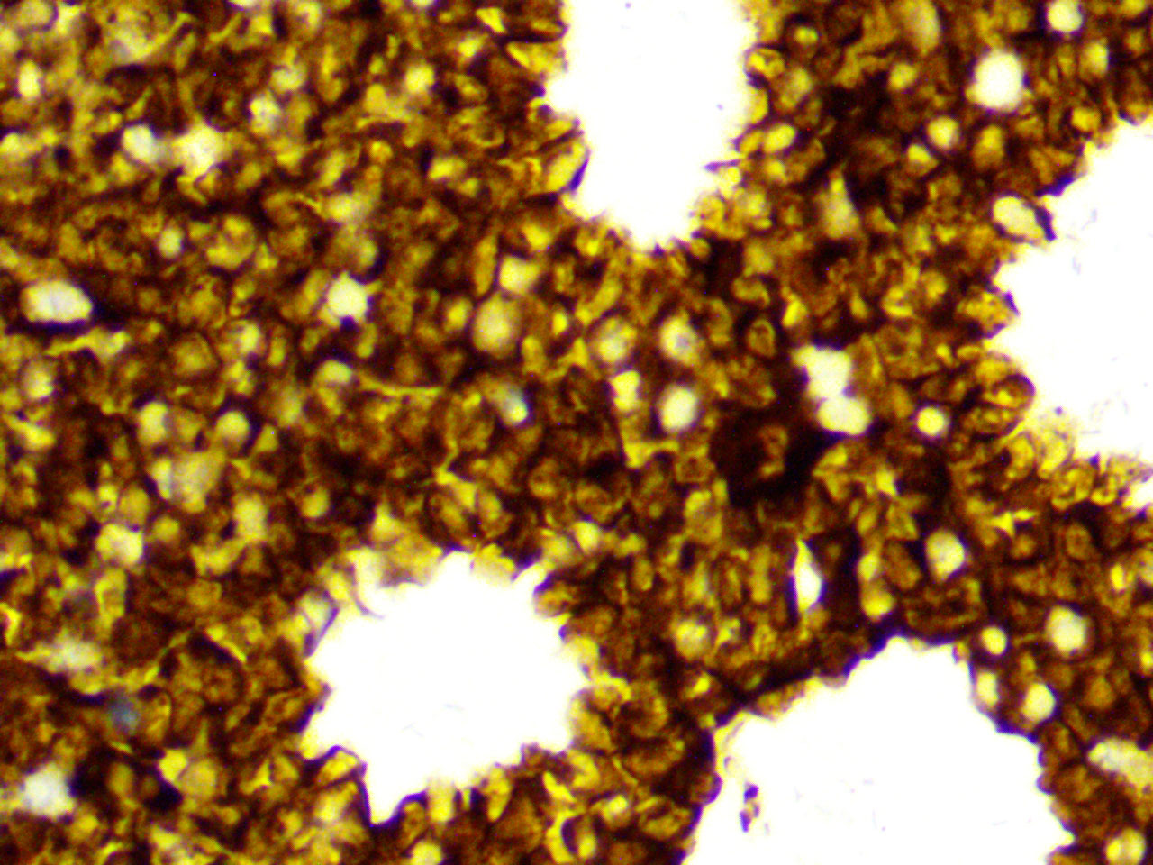 ihc2