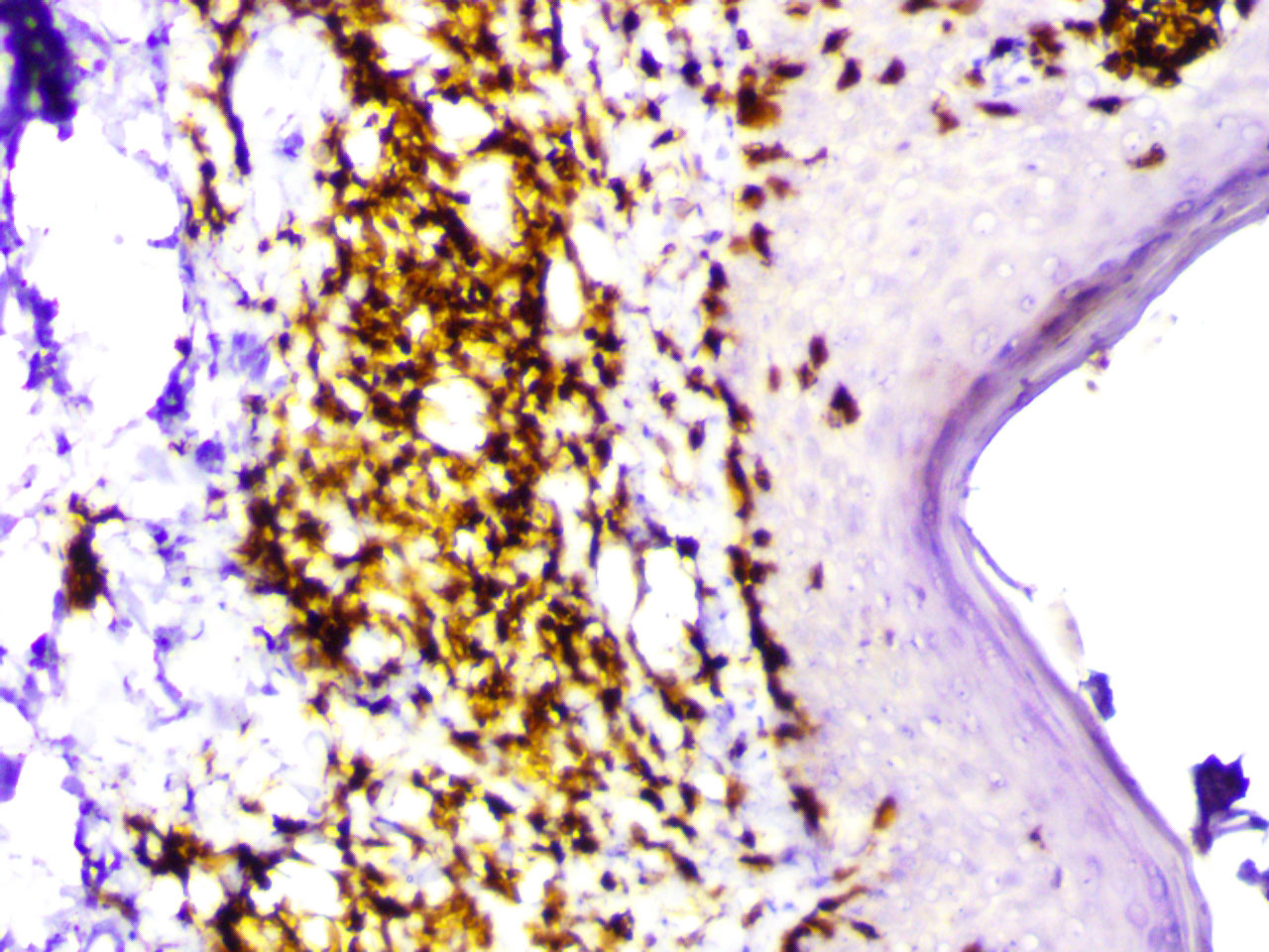 ihc3