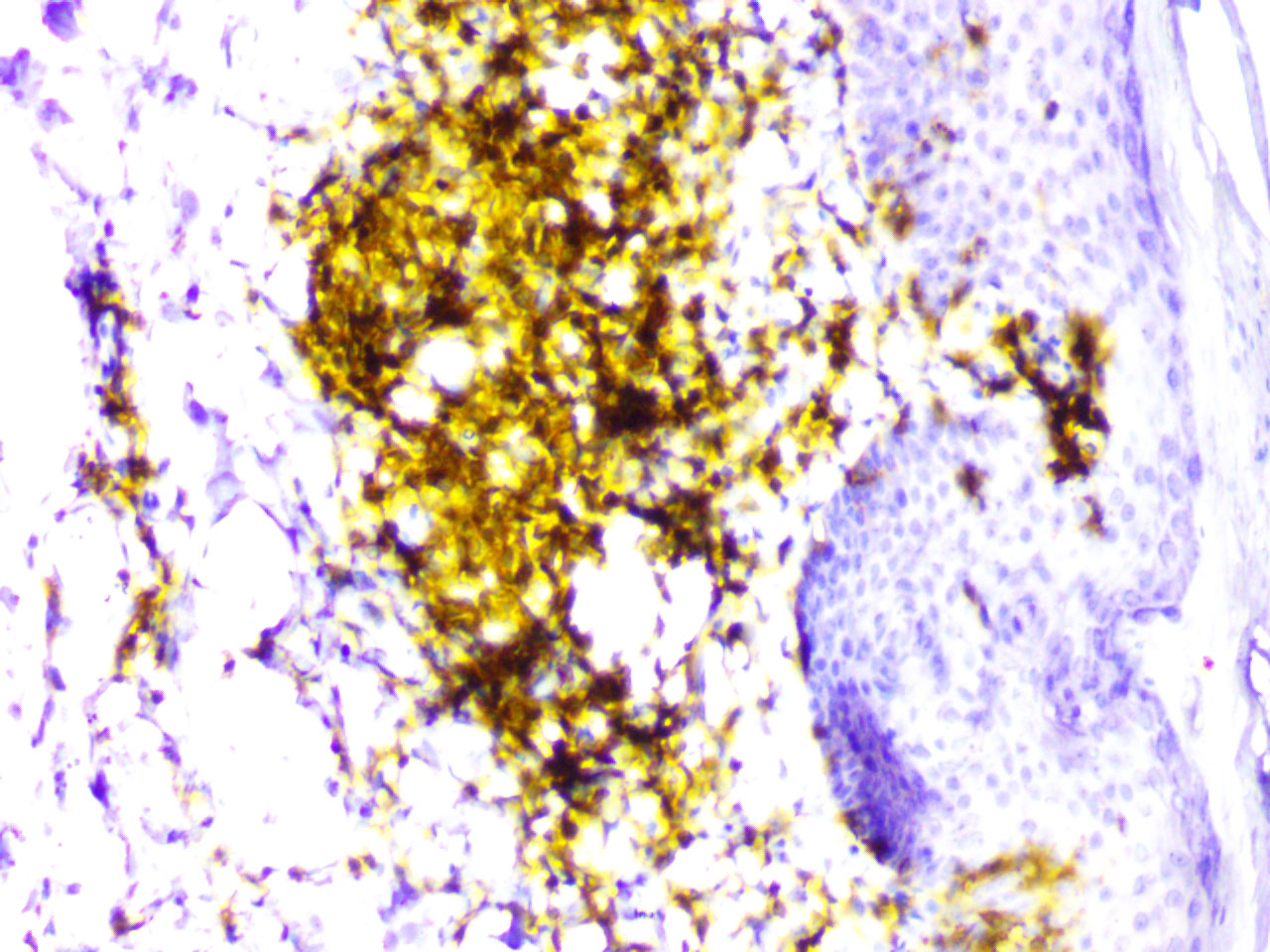ihc4