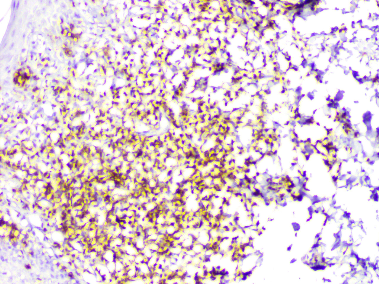 ihc5